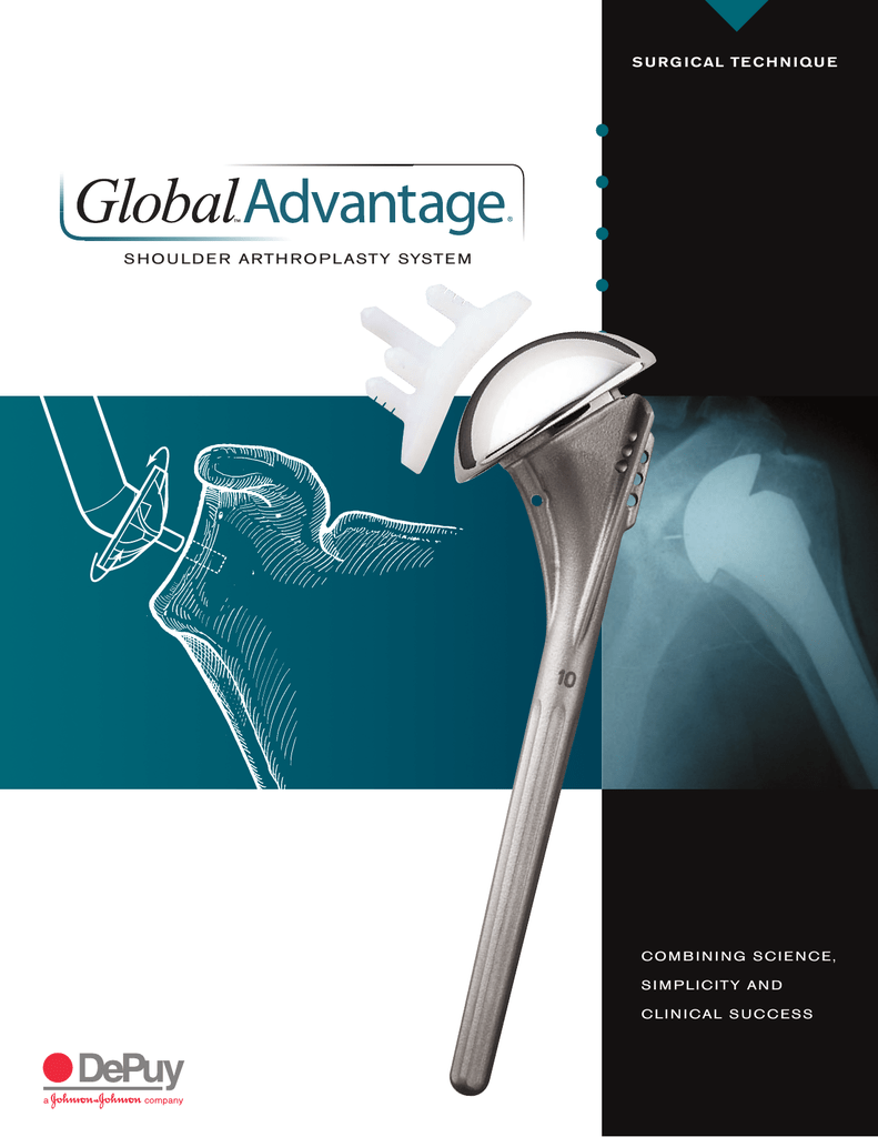 GLOBAL ADVANTAGE® Shoulder Arthroplasty System