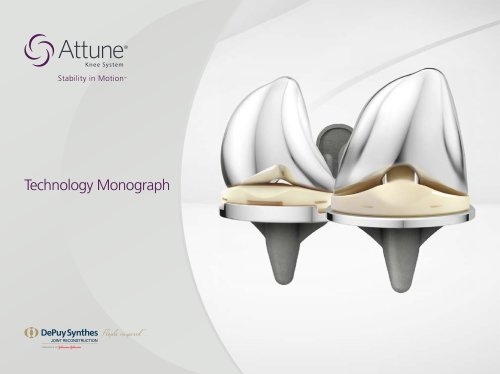 ATTUNE® Knee System