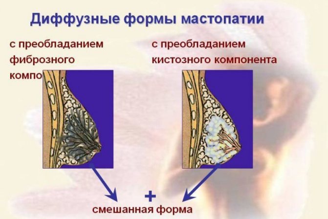 диффузная форма