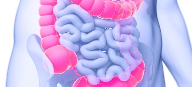 Дивертикулез кишечника: симптомы, лечение и диета