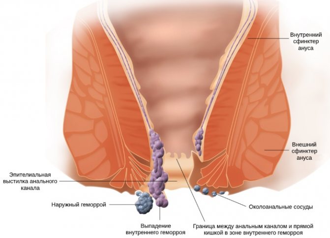 Форлакс для очищения кишечника. Отзывы, инструкция перед колоноскопией, рентгеном, при грудном вскармливании
