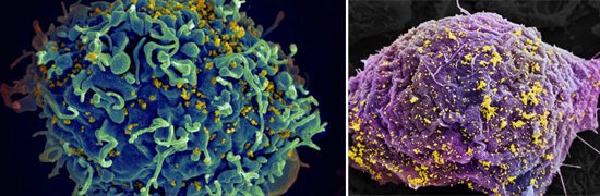 иммунные клетки вич