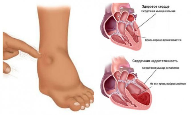 Информация о заболевании