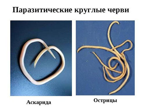 Как быстро вывести глисты у человека в домашних условиях