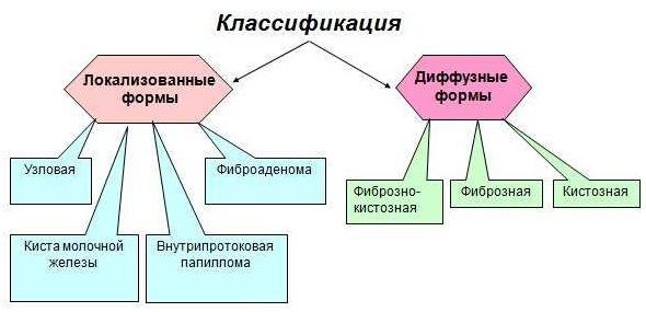классификация форм мастопатии