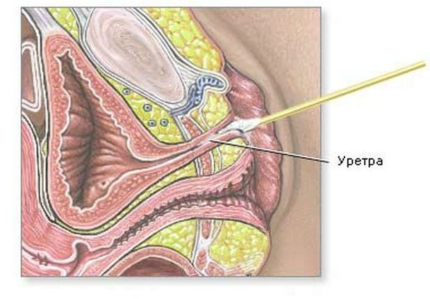Мазок из уретры у женщин без боли срочно в Москве.