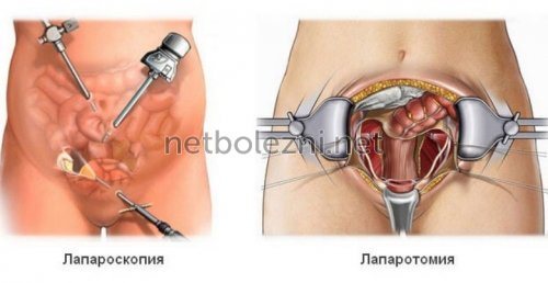 Методы хирургического лечения