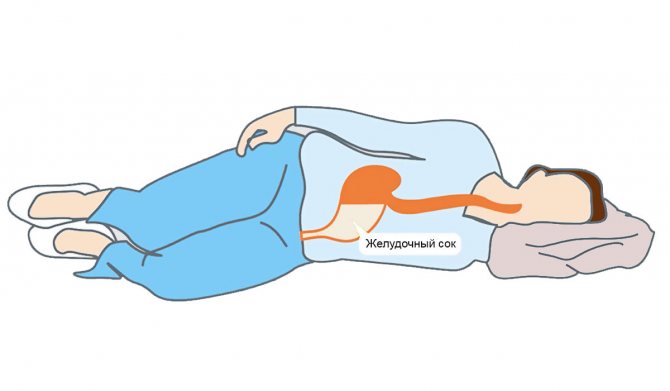На каком боку лучше спать с медицинской точки зрения