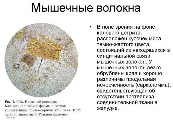 О чем говорит наличие мышечных волокон в кале при проведении анализа