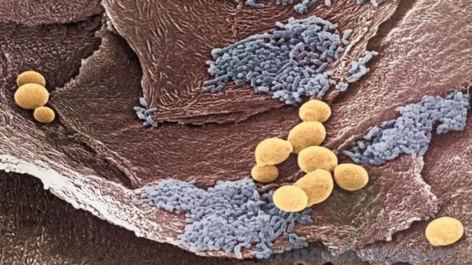 паразиты в желудке