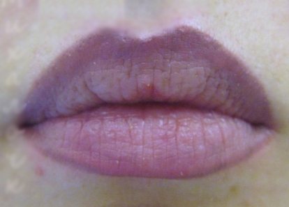 посинение губ