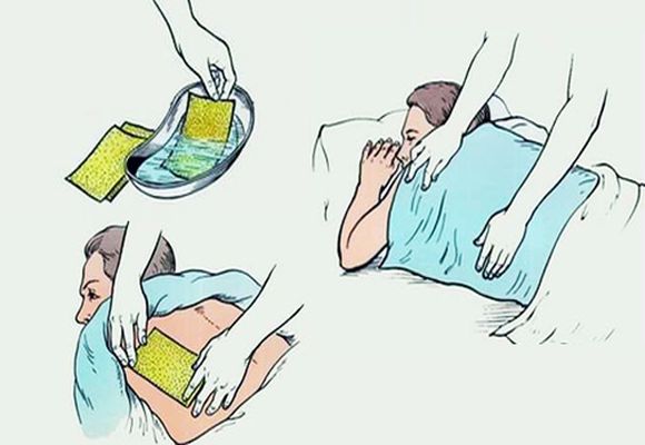 Схема наложения горчичников