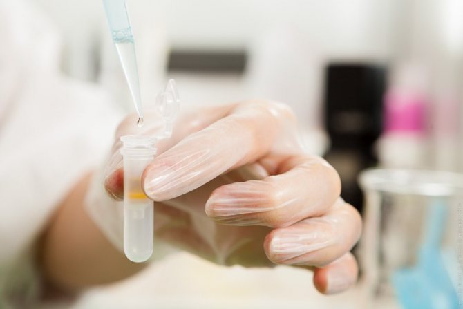 урологический мазок у мужчин