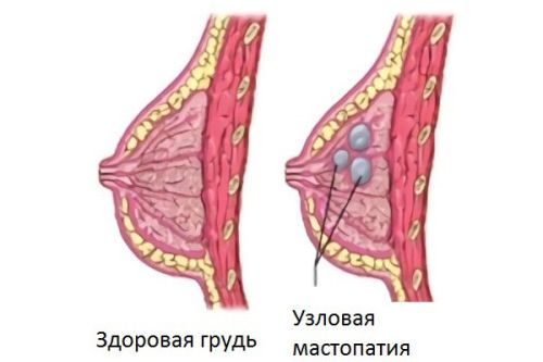 узловая форма