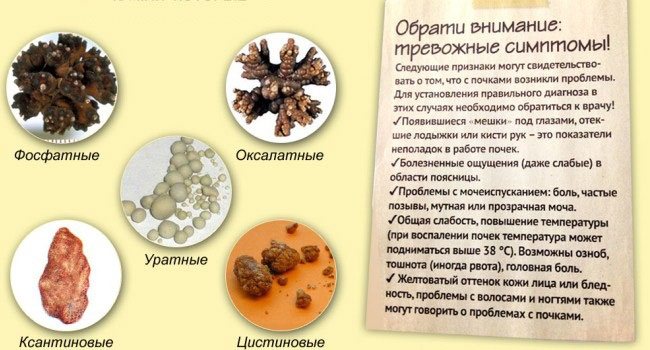 Виды камней
