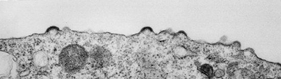 вирионы вич