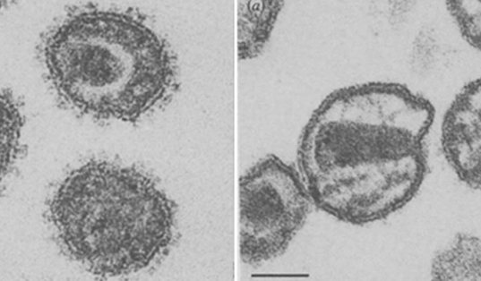 вирионы вич