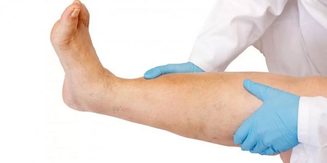 Врач осматривает ногу пациента