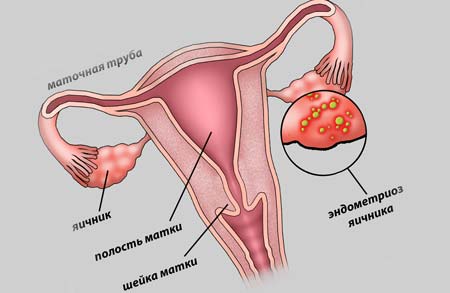 заболевание